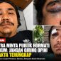 Terkait Pemberitaan Disalahsatu Media, Ini Penjelasan Korban Pengeroyokan Rudi Saputra dan Kapolsek Mandau